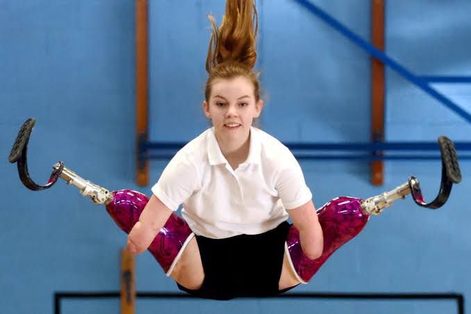 Tidak Memiliki Tangan dan Kaki, Izzy Weal Kini Menjadi Atlet Trampolin