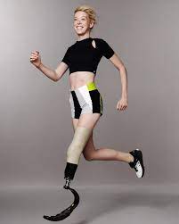 Adrianne Atlet Balet Dengan Disabilitas