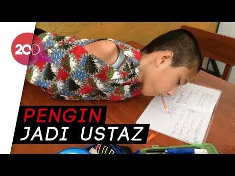 Haru Melihat Semangat Tio Bocah Tanpa Tangan dan Kaki Bersekolah