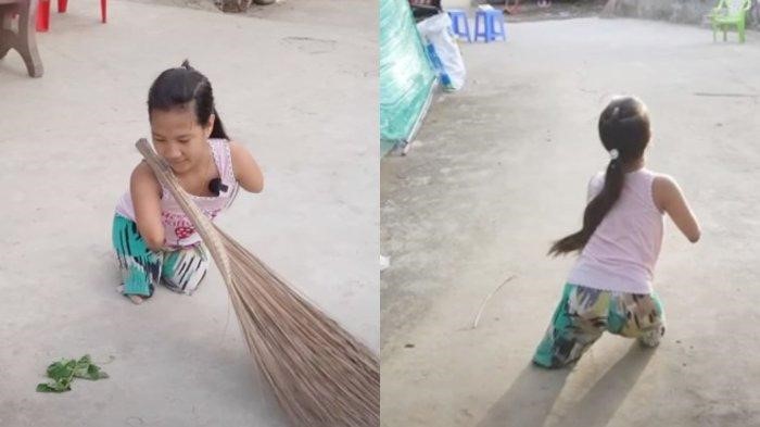 Dulu Viral ‘Gadis Penguin’ Tanpa Tangan & Kaki, Kini Tumbuh Membanggakan, Berprestasi di Sekolah