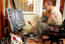 Peter Longstaff Terlahir Tanpa Lengan Akibat Ibunya Diberi Obat Thalidomide Selama Kehamilan, Tapi Peter Tidak Pernah Menganggap Dirinya Cacat