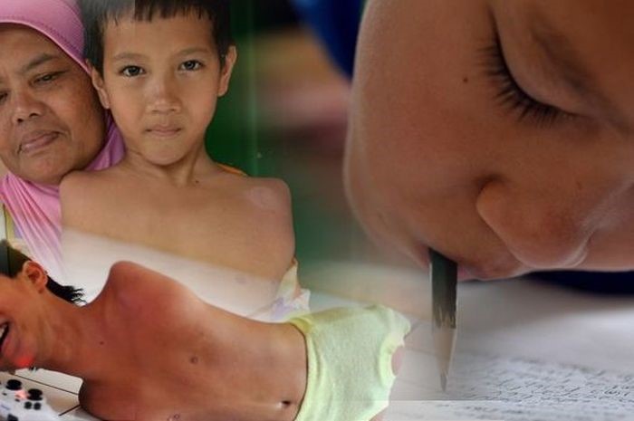 Tak Punya Tangan dan Kaki, Bocah Asal Ciamis Ini Jago Matematika, Mampu Kerjakan Soal Kelas 4 Padahal Baru Duduk di Kelas 2