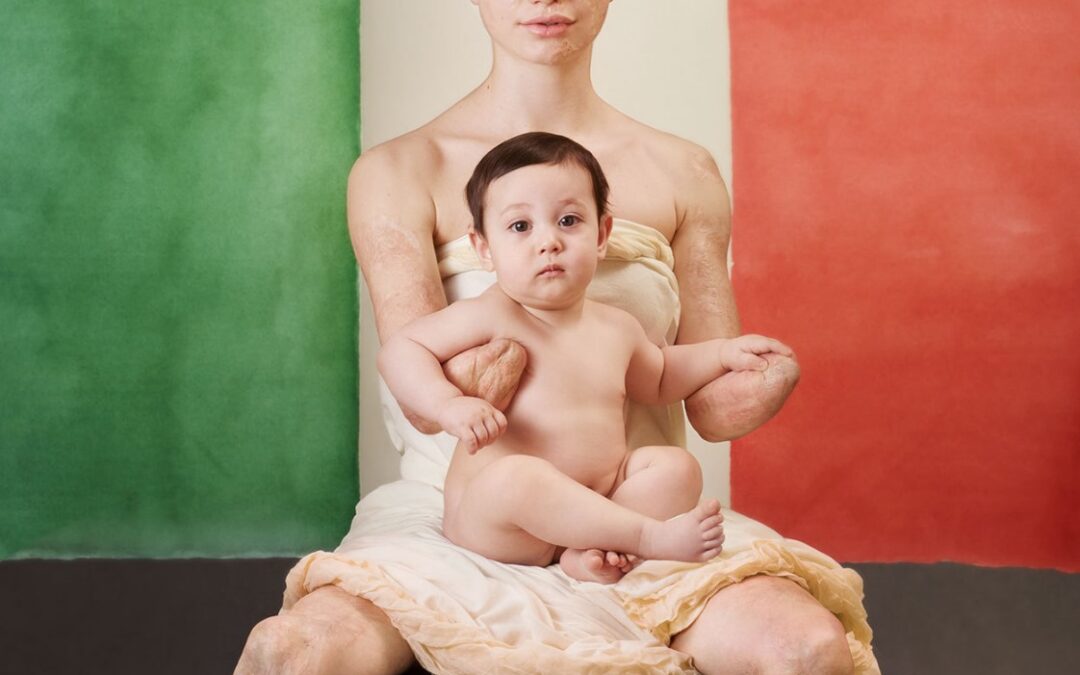 Atlet Disabilitas Asal Italia