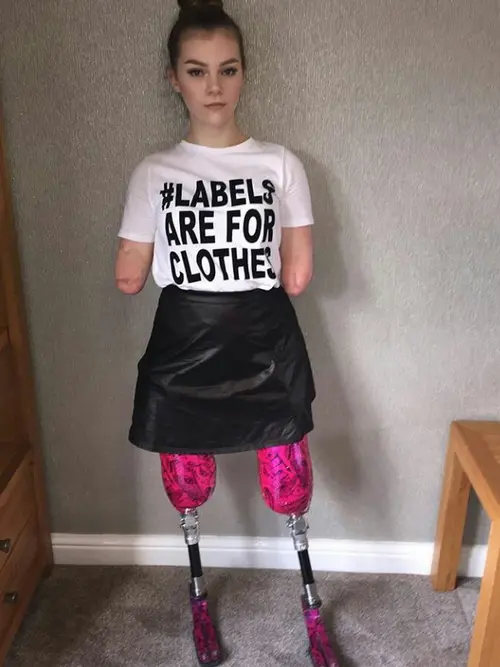 Seorang Wanita Muda disabilitas Sukses Menjadi Atlet Senam Trampoline