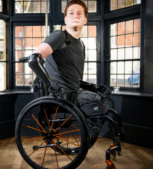 Alex Lewis: Transformasi Hidup Setelah Infeksi Parah dan Amputasi