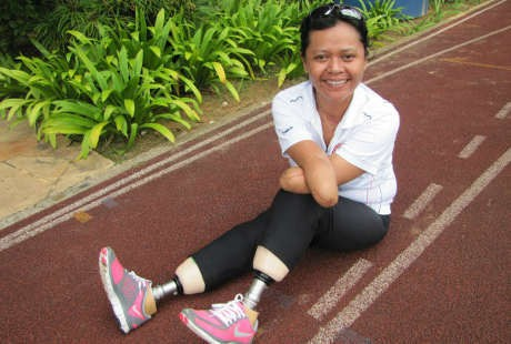 Bangkit dan Mandiri Setelah Kehilangan Anggota Tubuh