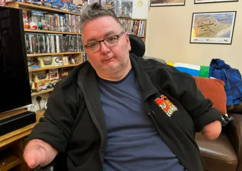 Orang cacat yang tidak memiliki tangan dan kaki dibiarkan tanpa pengasuh