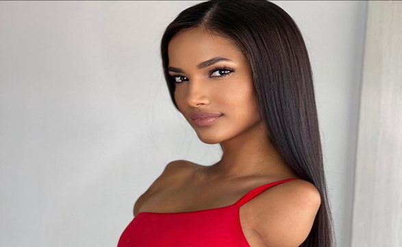 Kisah Wanita dengan Satu Kaki dan Tanpa Tangan Sukses Raih Mimpi Jadi Model