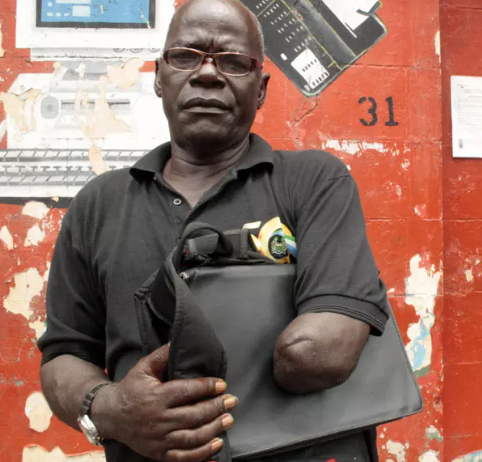 James Ponbu: Tantangan Hidup Setelah Amputasi dan Diskriminasi Sosial