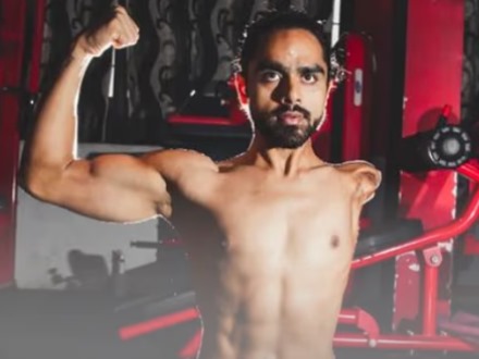 Tinkesh Kaushik: Dari Kecelakaan Listrik ke Kehidupan Baru