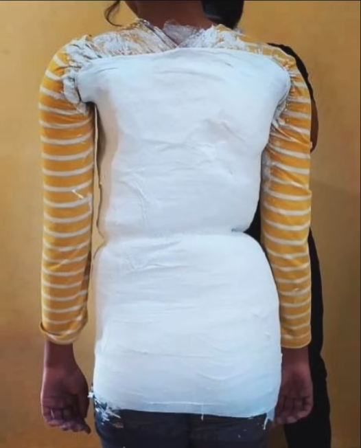 Ipoed Kaki Palsu 17-1-24