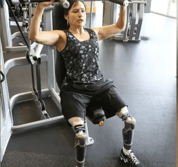 Yvonne Llanes: Janji yang Mengubah Hidup Setelah Amputasi