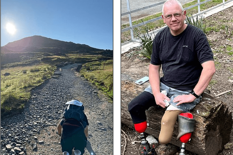 Cerita Pria Amputasi Ganda Mendaki 13 Jam ke Puncak Gunung