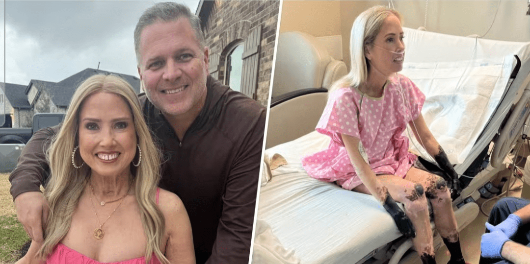 Sherri Moody: Kehilangan Kaki dan Tangan Akibat Sepsis