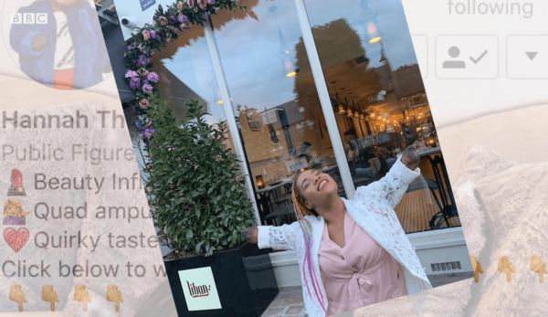 Hannah: Guru Kecantikan dan Inspirator yang Mengubah Perspektif tentang Amputasi Quad melalui Media Sosial