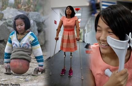 Kisah Perjuangan Gadis Tanpa Kaki hingga Jadi Atlet Renang Sukses