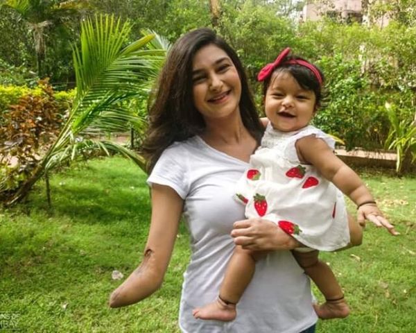 Dari Amputasi Hingga Kebahagiaan Keluarga