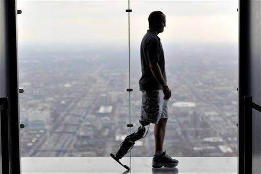 Zac Vawter dan Kaki Bionik Dikendalikan Pikiran