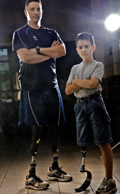 Perjalanan Hidup dengan Kaki Palsu