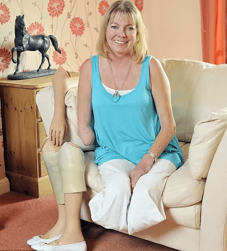 Dampak Fatal Diabetes yang Tak Terkendali