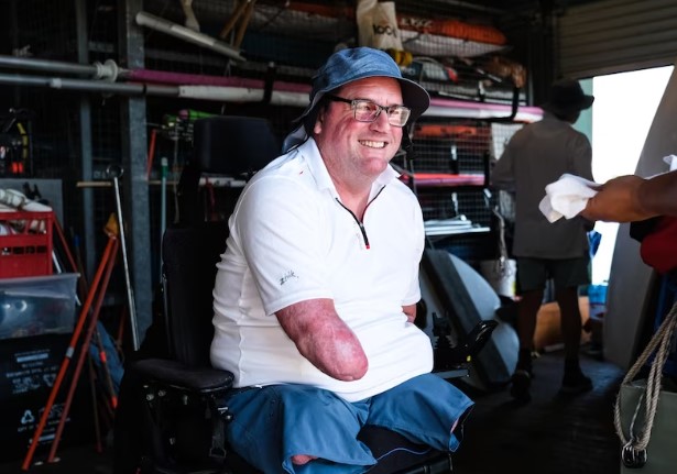 Kembali Menemukan Kebebasan Setelah Amputasi