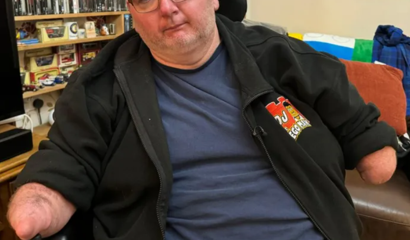 Pria Tanpa Tangan dan Kaki Kehilangan Bantuan Harian