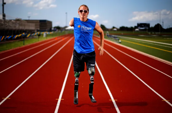 Cameron Clapp Menjadi Suara Positif Bagi Komunitas Amputasi