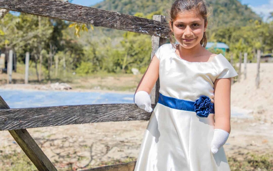 Cleidy, Anak Tanpa Tangan yang Menginspirasi Banyak Orang