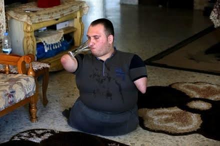 Keterbatasan Bukan Halangan: Youssef Berprestasi di Karate