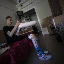 Daniyel Melnik, Tentara yang Hilang Tangan dan Kaki Lawan Rusia