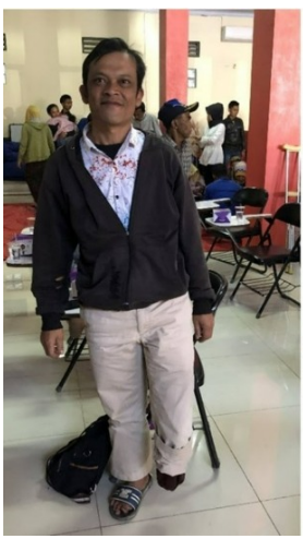 Tatan: Kaki dan Tangan Palsu Meningkatkan Kehidupan Disabilitas