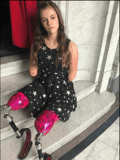 Isabelle Weall: Atlet dan Pebalap Tanpa Kaki dan Tangan