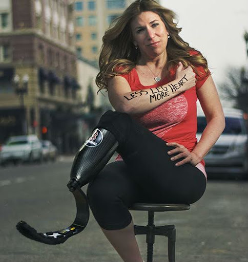 Heather Abbott: Membantu Amputasi Menemukan Aktivitas