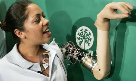 Lengan Prostetik Bionik: Bantu Claudia Menjalani Kehidupan