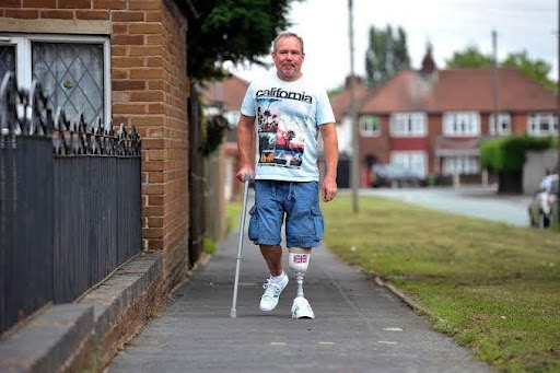 Robert David: Aktor, Musisi, dan Aktivis Penyandang Disabilitas