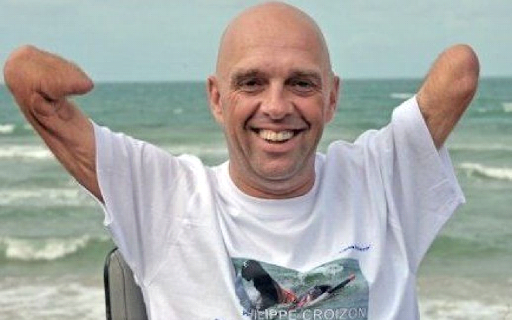 Philippe Croizon: Perenang Tanpa Tangan dan Kaki yang Menyelesaikan Perjalanan Keliling Dunia