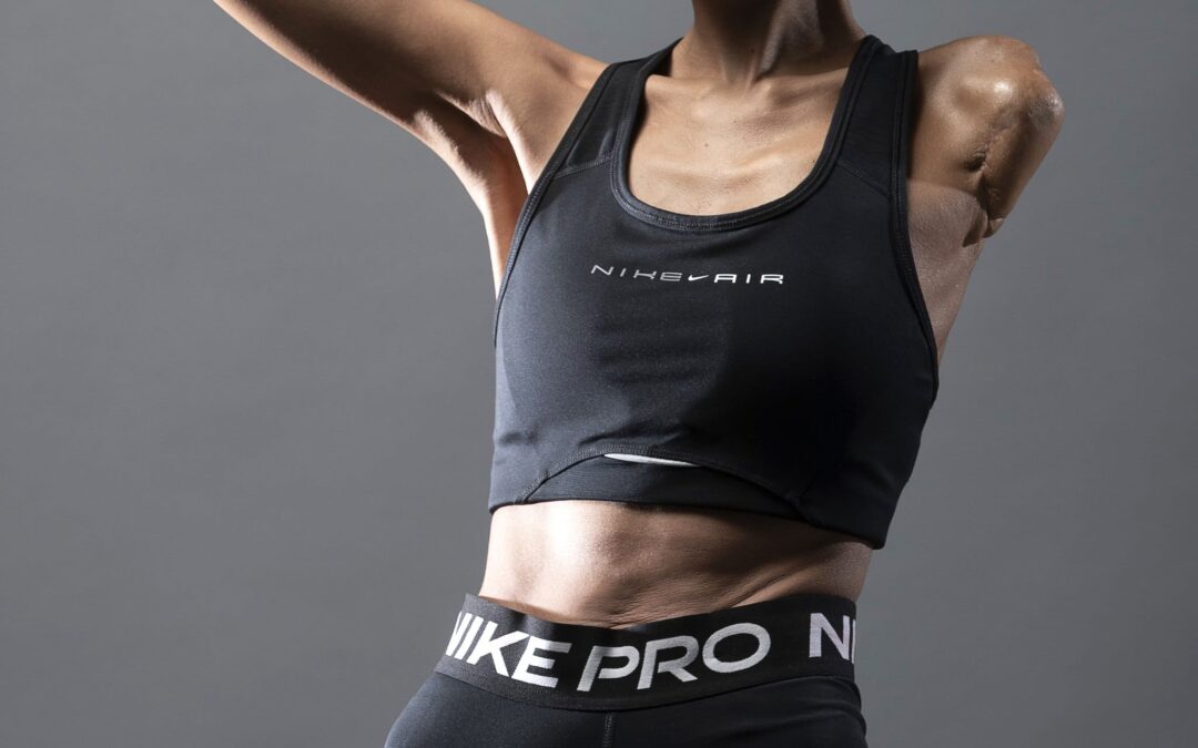 Kisah Inspiratif Kim Nayun: Kehidupan Baru Setelah Kecelakaan Fatal