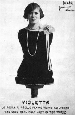 Aloisia Wagner: Kisah Inspiratif Perempuan Tanpa Tangan dan Kaki