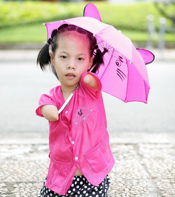 Linh Chi: Perjuangan Hidup Sejak Lahir