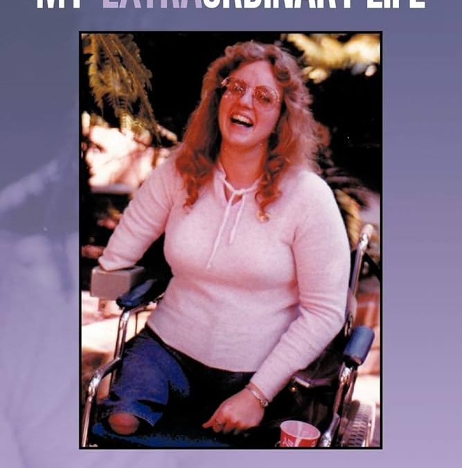 Monica sucha Vickers: Hidup Luar Biasa Tanpa Kaki dan Hanya Satu Tangan