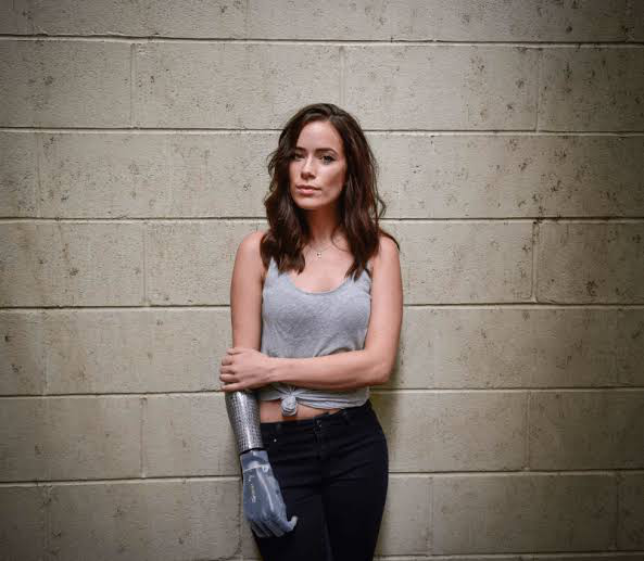 Rebekah Marine: Menyulap Keterbatasan Menjadi Kekuatan di Dunia Mode