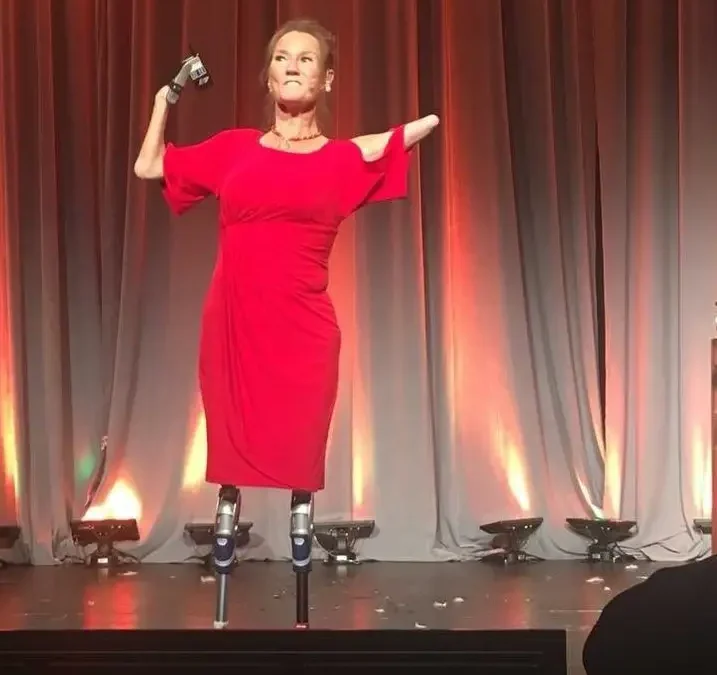 Unstoppable Tracy: Kisah Inspiratif Perempuan Tanpa Tangan dan Kaki