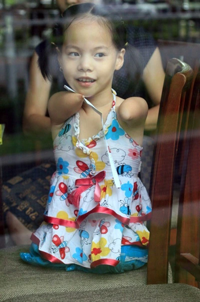 Inovasi Linh Chi dalam Belajar Berjalan