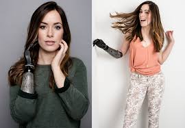 Rebekah Marine: Kekuatan dan Keberanian di Balik Prostetik”