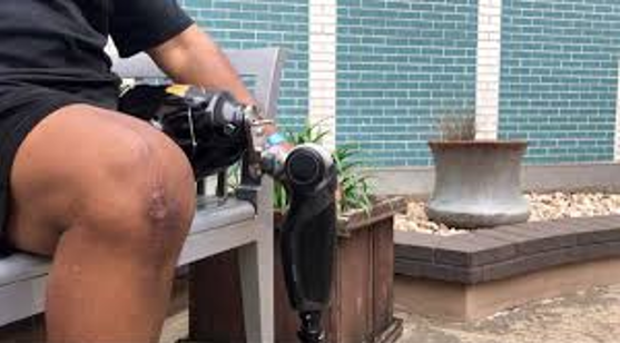 Veteran menggunakan POWER KNEE prostetik bertenaga AI untuk berjalan dan menaiki tangga dengan lebih stabil.