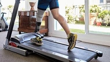 Rehabilitasi setelah amputasi dengan latihan menggunakan kaki prostetik bersama fisioterapis