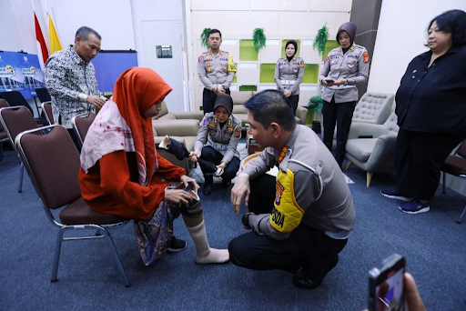 Penerima bantuan kaki palsu mencoba prostesis baru untuk mendukung aktivitas sehari-hari