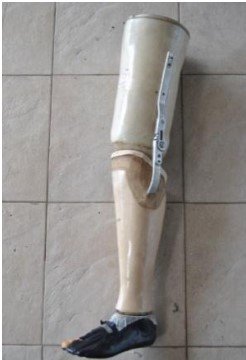 Perancangan Above Knee Prosthetic untuk Pasien Amputasi Kaki di Atas Lutut