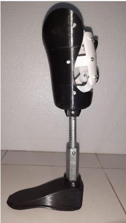 Inovasi Prostesis Bawah Lutut dengan Shank Adjustable Berbasis Ulir