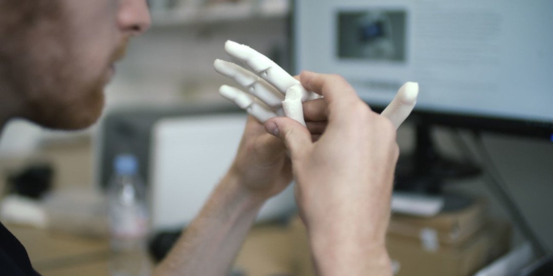 Prostesis Tangan 3D, Inovasi Open Bionics yang Lebih Terjangkau
